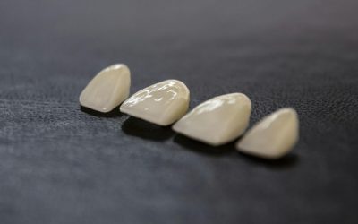 how much are dental implants
