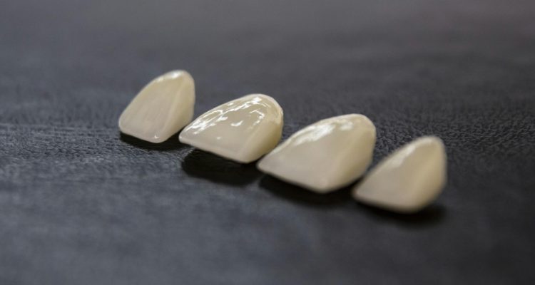 how much are dental implants