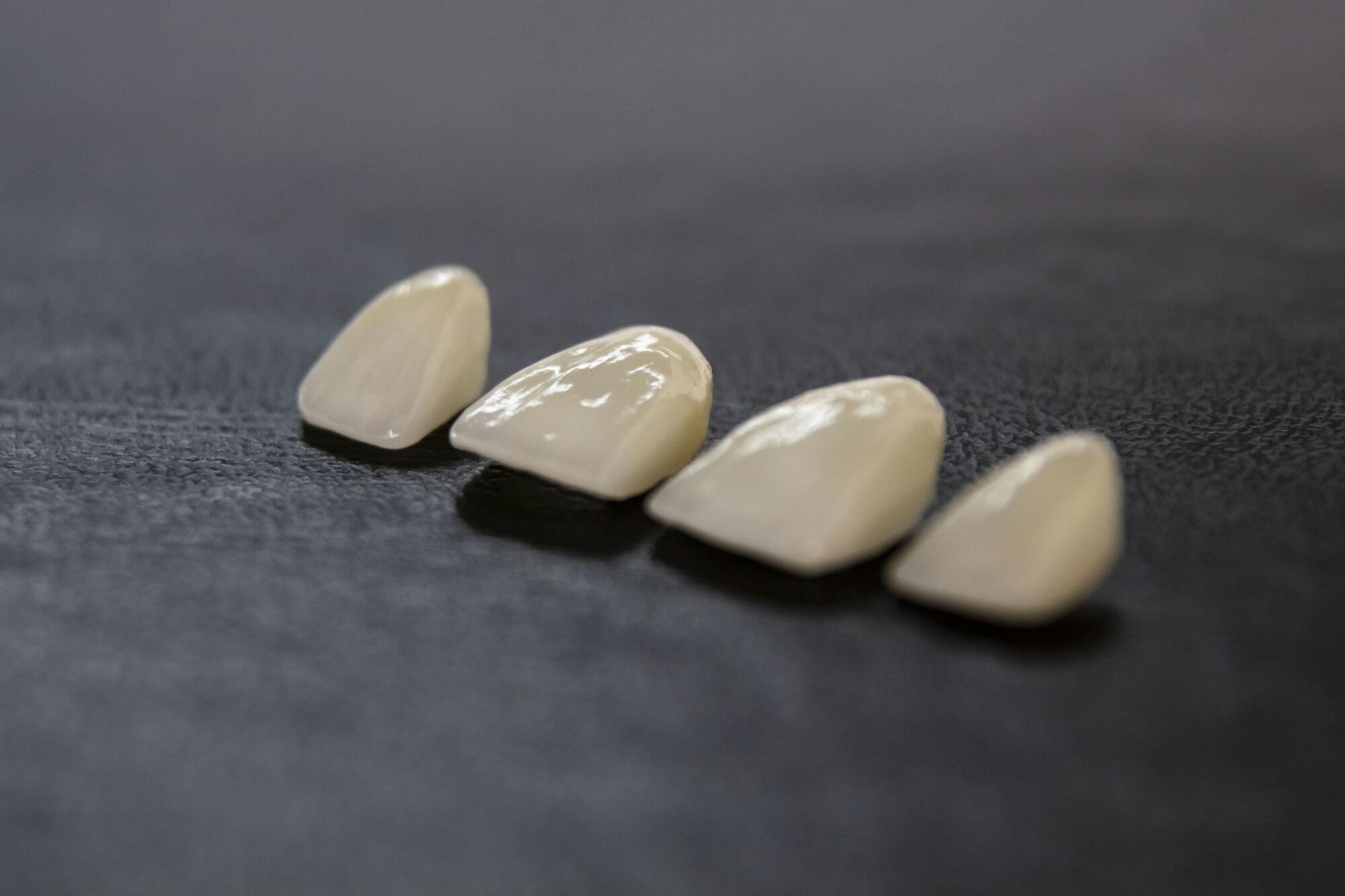 how much are dental implants