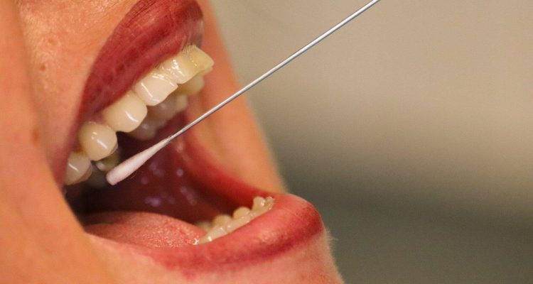 mouth biopsy