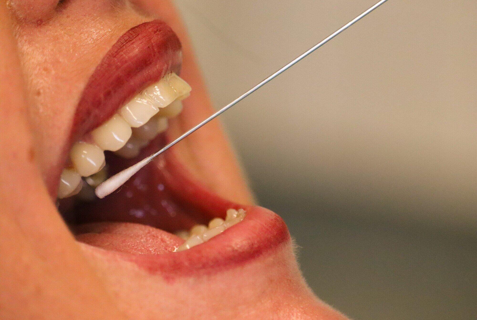 mouth biopsy