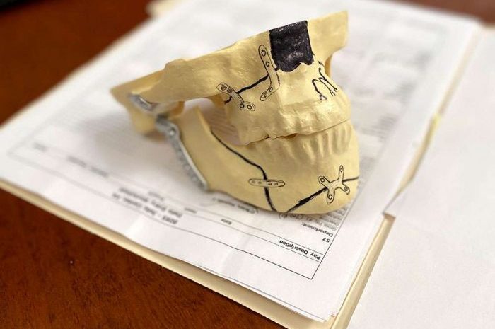 maxillofacial_procedures3-e1652994197474
