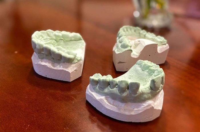 oral_procedures1-e1652994280851