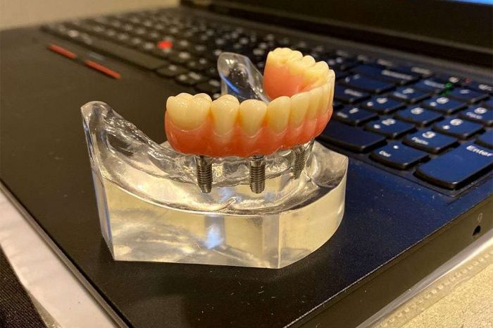 oral_procedures2-e1652994341131